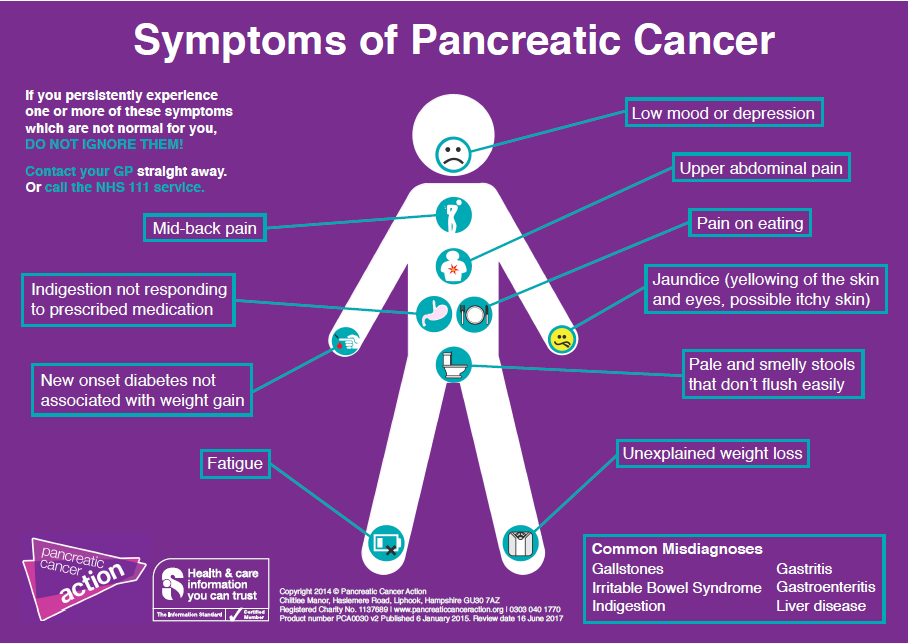 symptoms of pancreatic cancer