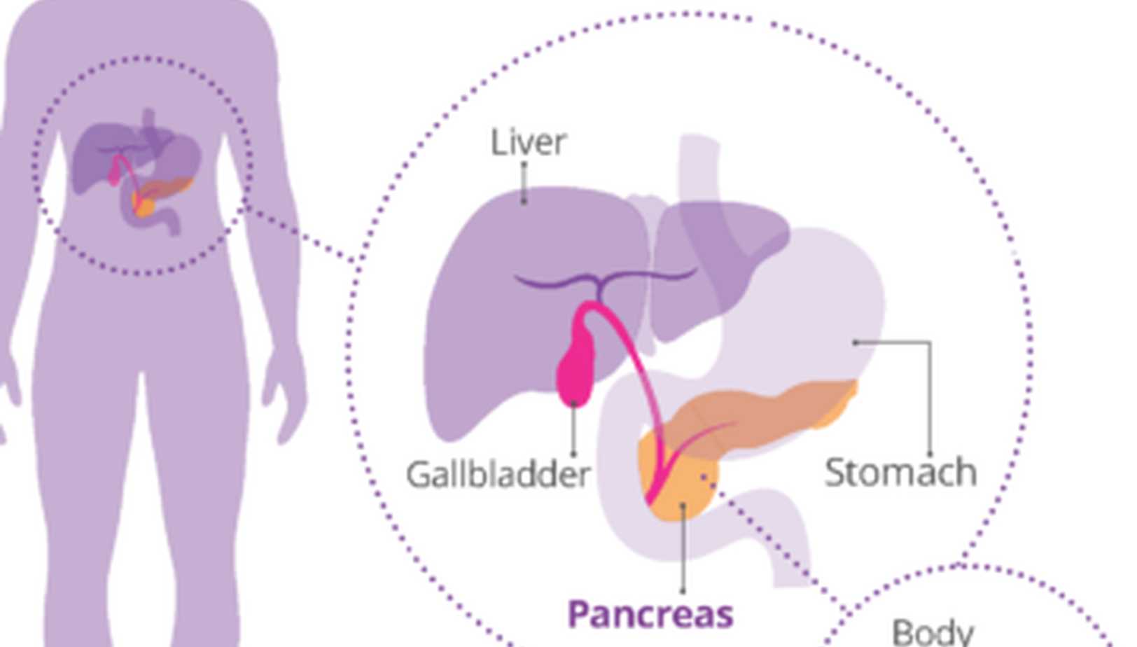An image of the human body highlighting where the pancreas is located, with a close up image showing the pancreas and its neighbouring organs.