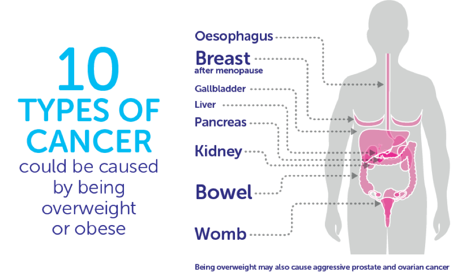 CRUK obesity and cancer risk top 10