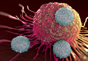 T-cells attacking cancer cell, pancreatic cancer immunotherapy