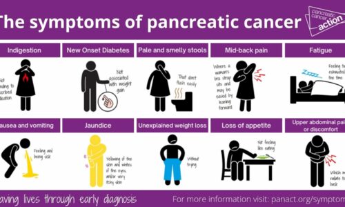 pancreatic cancer symptoms